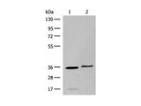 LGALS4 Polyclonal Antibody