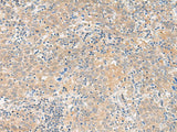 GALP Polyclonal Antibody