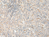 GALR1 Polyclonal Antibody