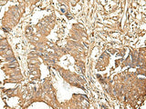 GALR2 Polyclonal Antibody