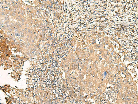 GALR2 Polyclonal Antibody