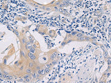 GALR3 Polyclonal Antibody