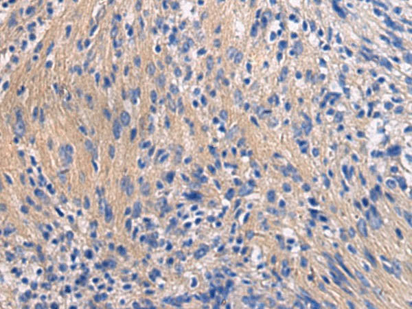 GALR3 Polyclonal Antibody