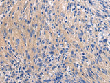 GALR3 Polyclonal Antibody