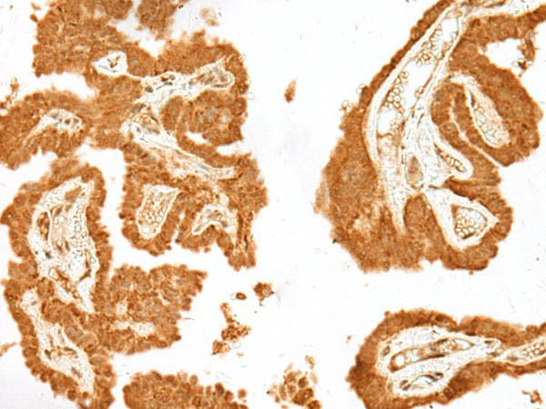 GANC Polyclonal Antibody