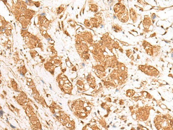 GANC Polyclonal Antibody