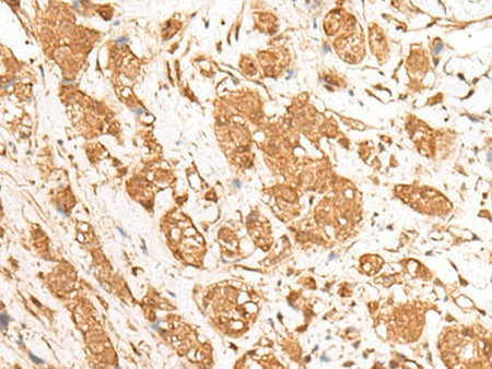 GANC Polyclonal Antibody