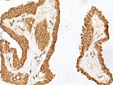 RALGAPA1 Polyclonal Antibody