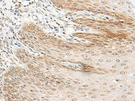 RALGAPA1 Polyclonal Antibody