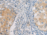 GBA Polyclonal Antibody