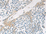GBA Polyclonal Antibody