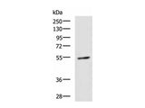 GBA Polyclonal Antibody