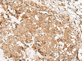 GBGT1 Polyclonal Antibody