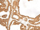 GBGT1 Polyclonal Antibody