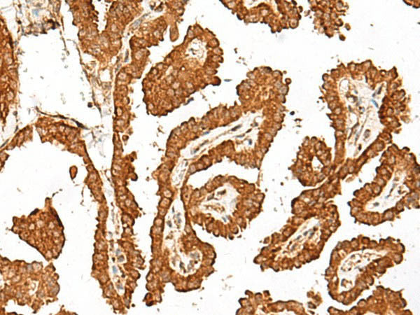 GBP4 Polyclonal Antibody