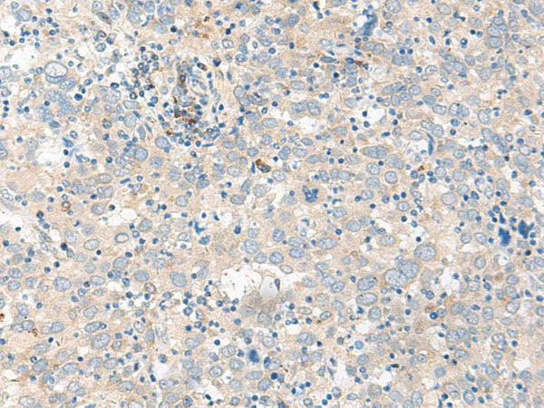 GUCA1B Polyclonal Antibody