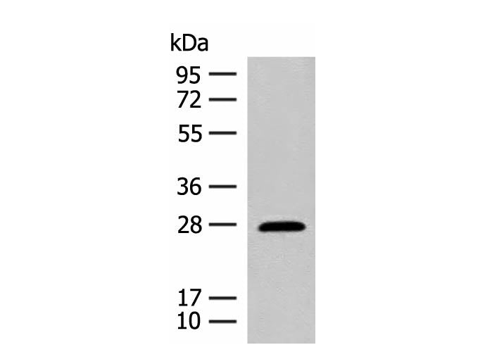 GUCA1B Polyclonal Antibody