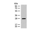 GUCA1B Polyclonal Antibody