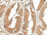 GCC2 Polyclonal Antibody