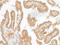 CXCL6 Polyclonal Antibody