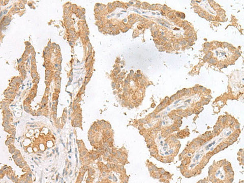 CXCL6 Polyclonal Antibody