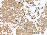 GRASP Polyclonal Antibody
