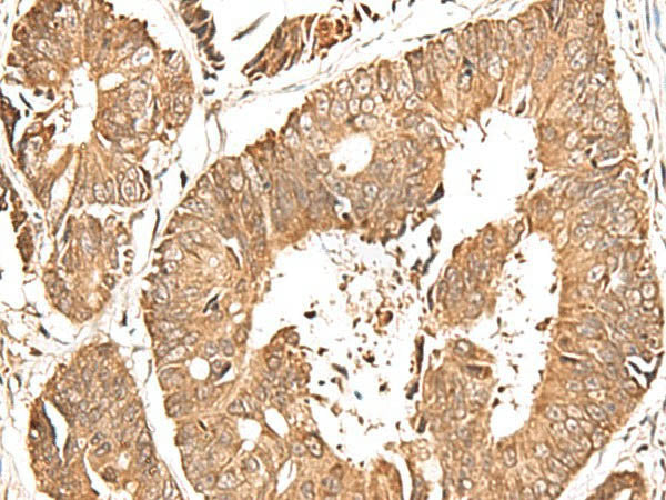 GFI1 Polyclonal Antibody