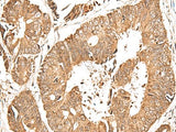 GFI1 Polyclonal Antibody