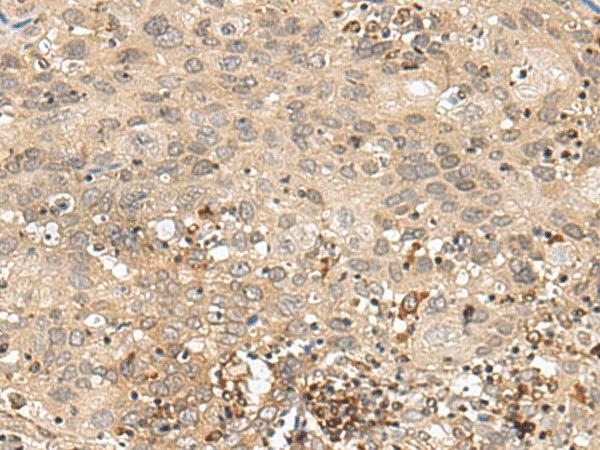 GFI1 Polyclonal Antibody