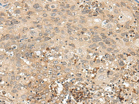 GFI1 Polyclonal Antibody