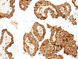GFI1B Polyclonal Antibody