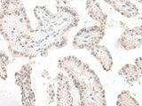 GHDC Polyclonal Antibody