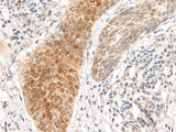 GHDC Polyclonal Antibody