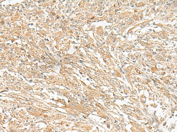 GIPC1 Polyclonal Antibody
