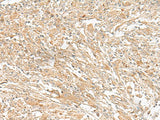 GIPC1 Polyclonal Antibody
