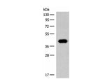 GIPC1 Polyclonal Antibody