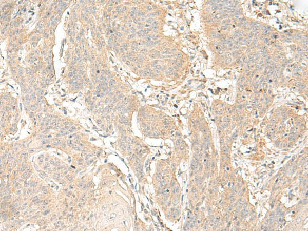 GLIS1 Polyclonal Antibody