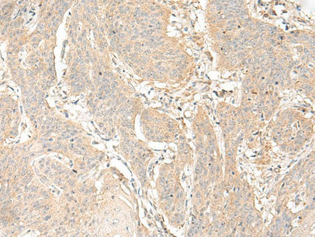 GLIS1 Polyclonal Antibody