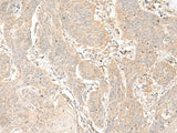 GLIS1 Polyclonal Antibody
