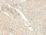 GLIS1 Polyclonal Antibody