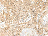 BICRA Polyclonal Antibody