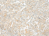 GP6 Polyclonal Antibody