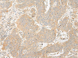 GP6 Polyclonal Antibody