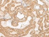 SLC6A9 Polyclonal Antibody