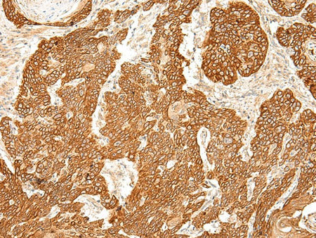SLC6A9 Polyclonal Antibody