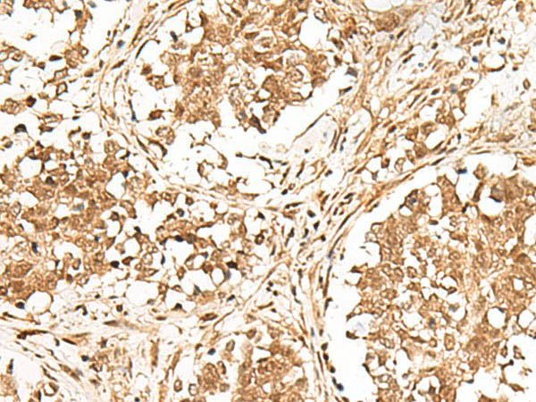 GMEB2 Polyclonal Antibody