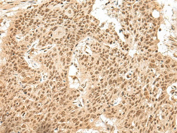 GMEB2 Polyclonal Antibody
