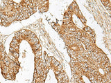 GNAT1 Polyclonal Antibody