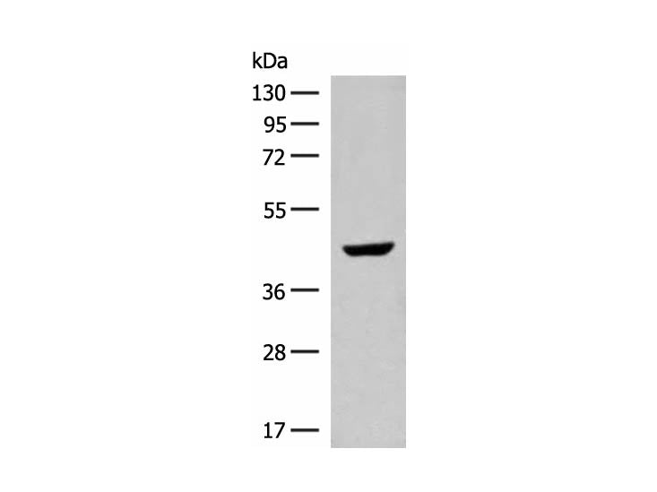 GNAT1 Polyclonal Antibody