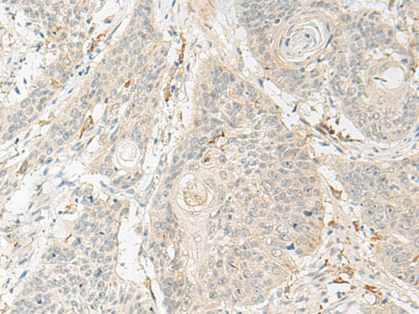 GNAT3 Polyclonal Antibody Store at -20°C